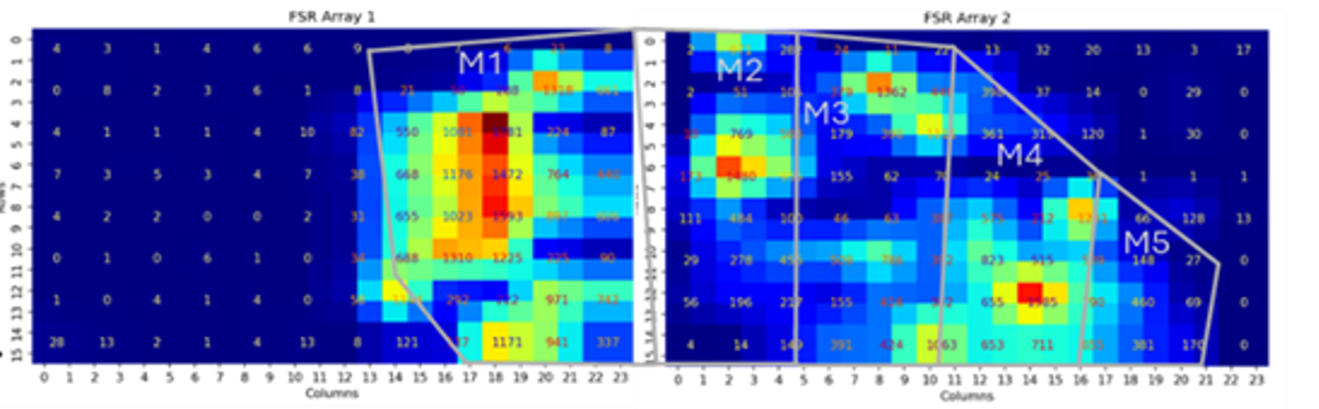 LTS: pressure-sensor arrays mapping load across the metatarsals M1 to M5